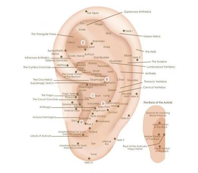 What Are Ear Seeds? All About The Stress-Relieving Wellness Trend ...